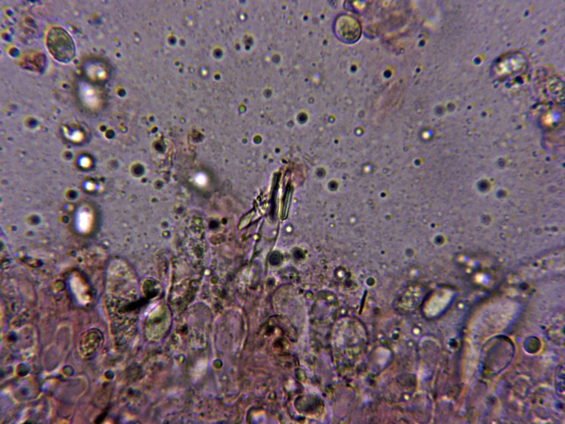 Microscopía de Melanoleuca substrictipes - 10 - Queilocistidio 1